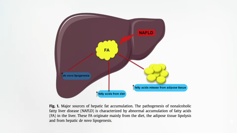 Treating Fatty Liver Disease with Diet 