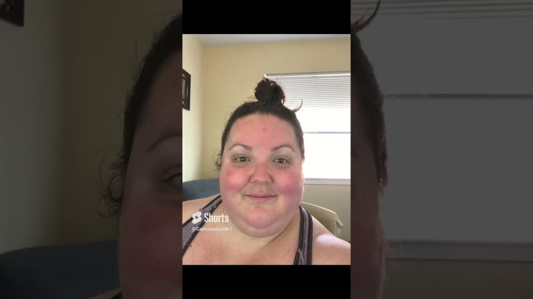 My 116 lbs. 10 month weight loss transformation #health #weightloss #carnivore