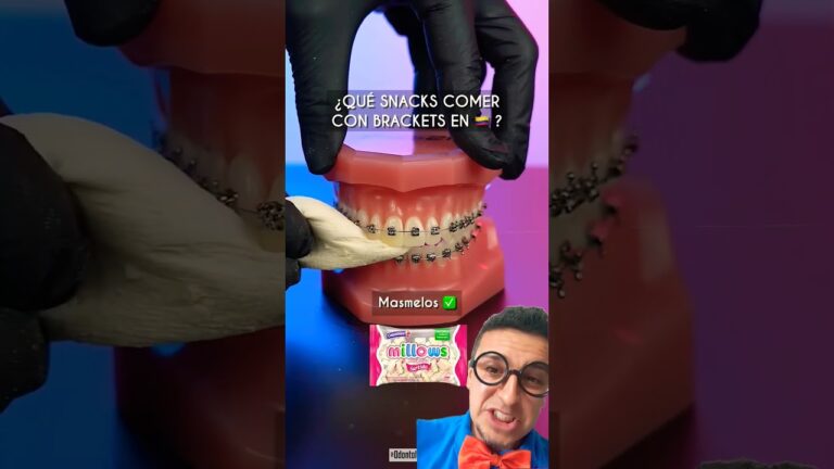 qual doce comer com dentadura #teethwhitening #orthodontist #dentist #funnydentalclinic