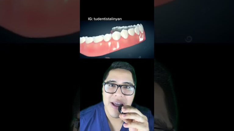 ¿Sin dientes? mira como EL IMPLANTE DENTAL te devuelve TU SONRISA