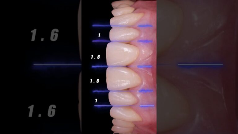 join the Course Now | Dental motion graphics #dentistry
