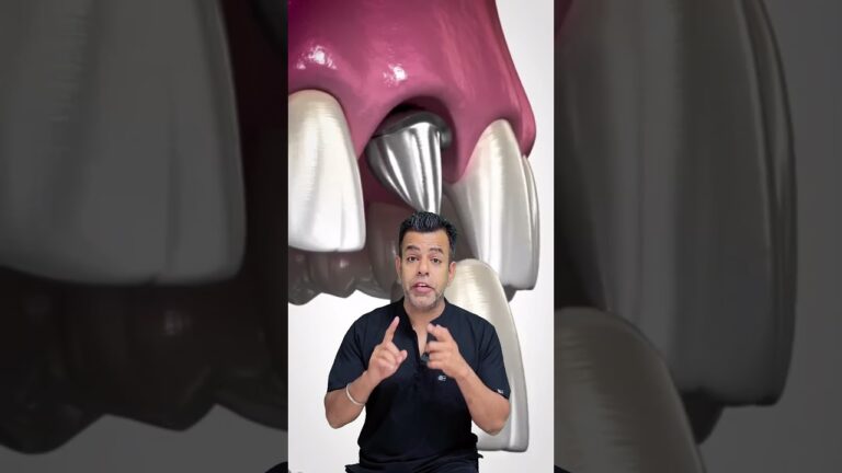 Master Dental Implants comprehensive clinical training #youtubeshorts #youtubevideo #dentalcourses