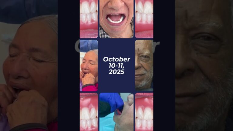 Mastering Mandibular Suction | Complete Dentures CE Course – October 2025, Sarasota FL