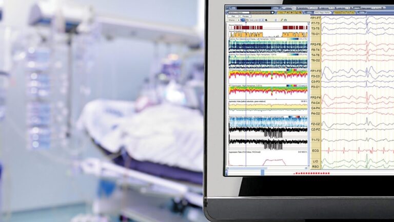 I had to take a Polysomnography test….