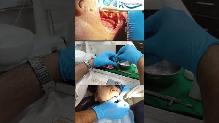 Missing Teeth? Discover Solutions for All Your Dental Problems at Dr. Contractor Dental Care