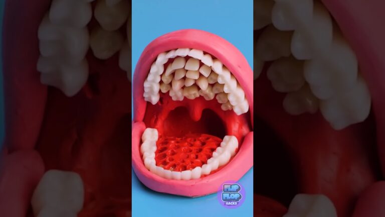 You Won’t Believe This Strange and Gross Dental Case! 🦷🤢