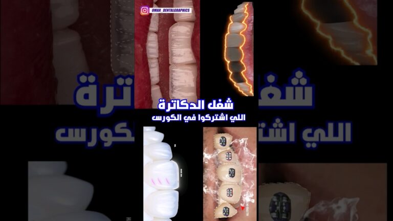 Students' Work in our Dental Motion Course