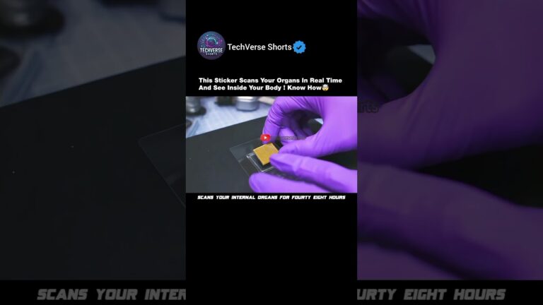 This Sticker Scans Your Organs! 🧠💥#shorts#ultrasound
