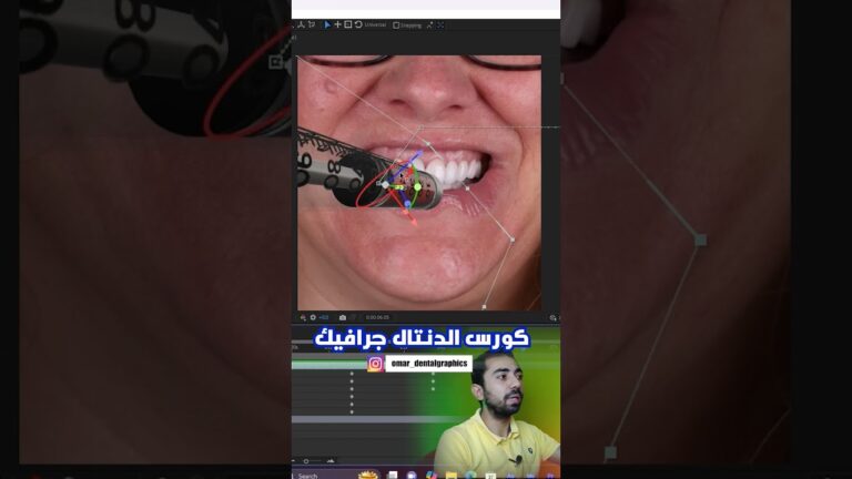 Glimpses of the Dental motion graphics Course