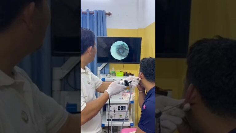 POV: Exploring Deep Inside the Ear Canal! 🎥👂 #EarEndoscopy #DoctorView
