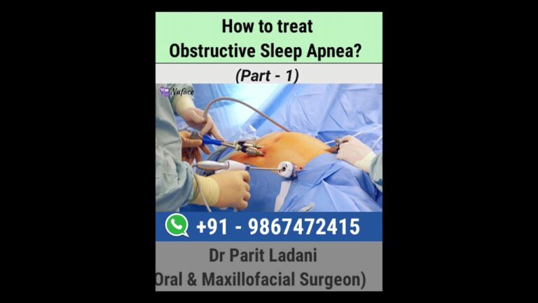 Treatment for Obstructive Sleep Apnea | Dr Parit Ladani