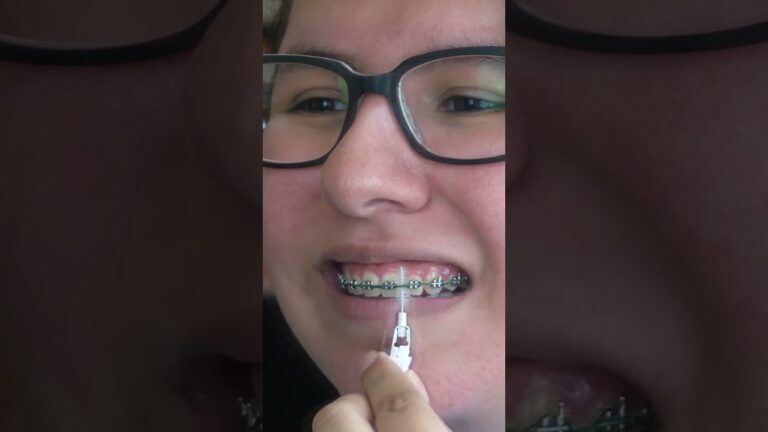 Proxabrush With Braces | English