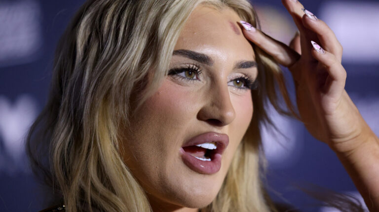 A Joke Reveals What WWE Stars’ Teeth Are Really Like