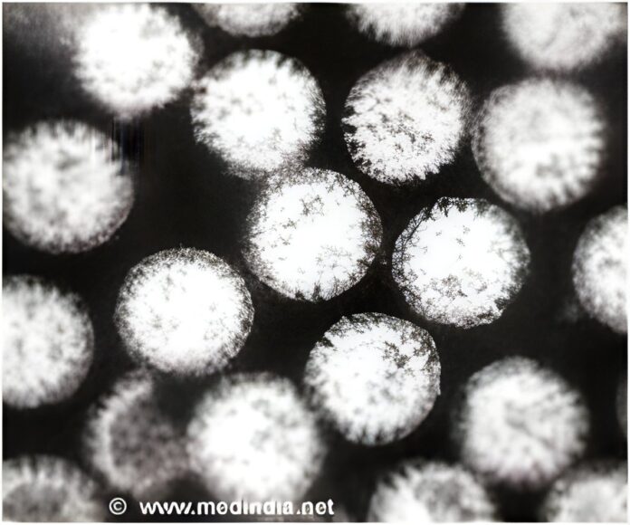 norovirus.jpg
