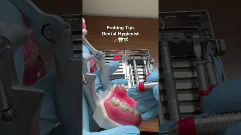 Dental hygiene school tips for probing #dentalhygieneschool #dentalhygienist #hygienist